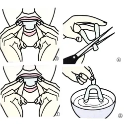 Blanqueamiento dentalProtector bucal de silicona durante la noche - blanqueamiento dental - contra rechinar / apretar - 4 piezas