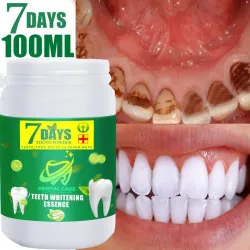 Blanqueamiento dentalPolvo blanqueador de dientes - Eliminador de placa / manchas - Aliento fresco