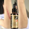 MasajeAceite de masaje de lavanda - extracción de cicatriz - anti acné - serum ácido hialurónico