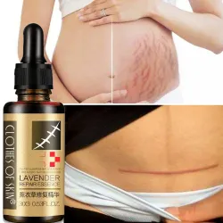 MasajeAceite de masaje de lavanda - extracción de cicatriz - anti acné - serum ácido hialurónico